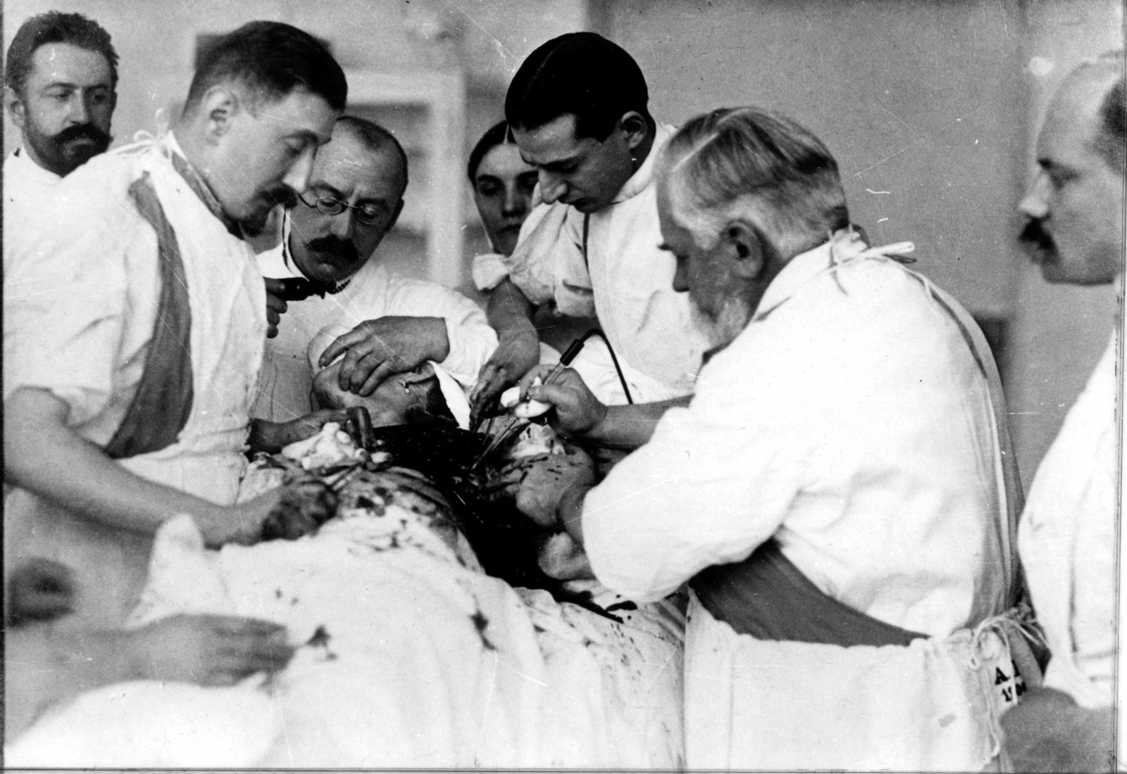 Brust Op Vinzenz Czerny Dr Richard WErner 1900